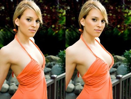 Breast-Enlargement.jpg